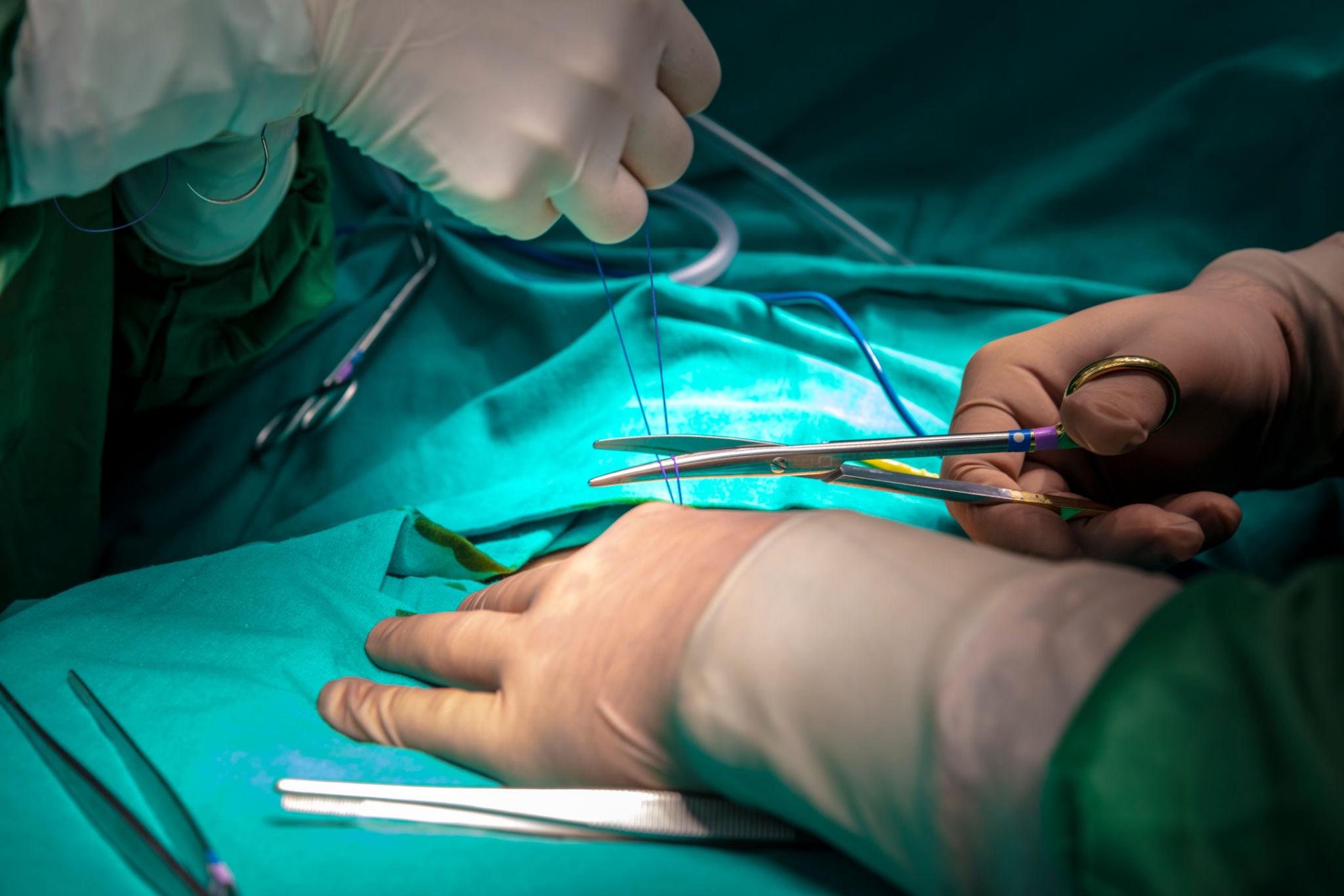 Suturing for suitable minor wounds in Rawang